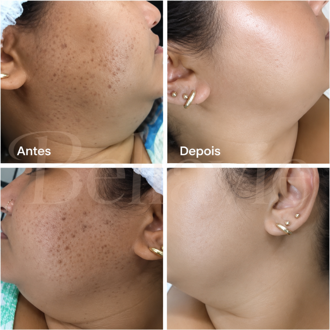 CREME DR.VERRUGA